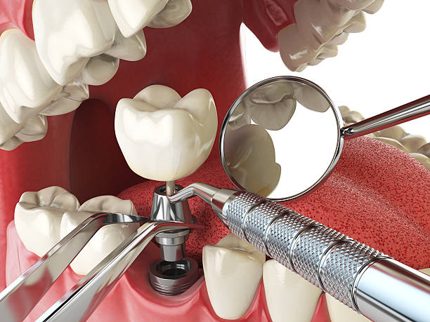 Best Tooth Pain Emergency Relief  in Farmer City, IL